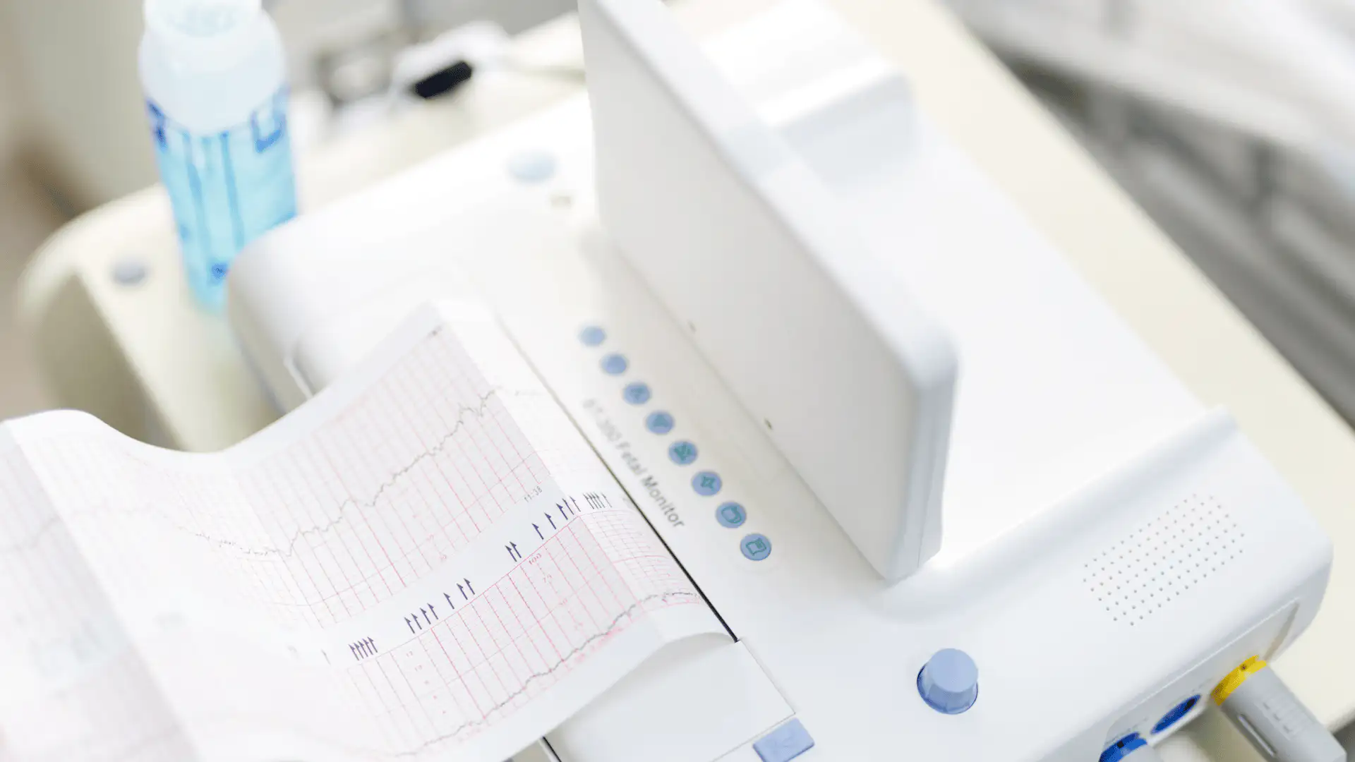 CTG vizsgálat - Haller Medical