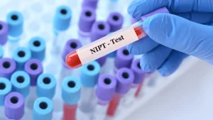 NIPT teszt a Haller Medical rendelőben
