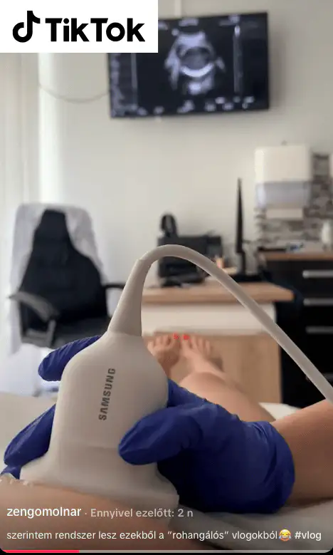 Bévárdi-Molnár Zengő genetikai ultrahang vizsgálata a Haller Medical rendelőben